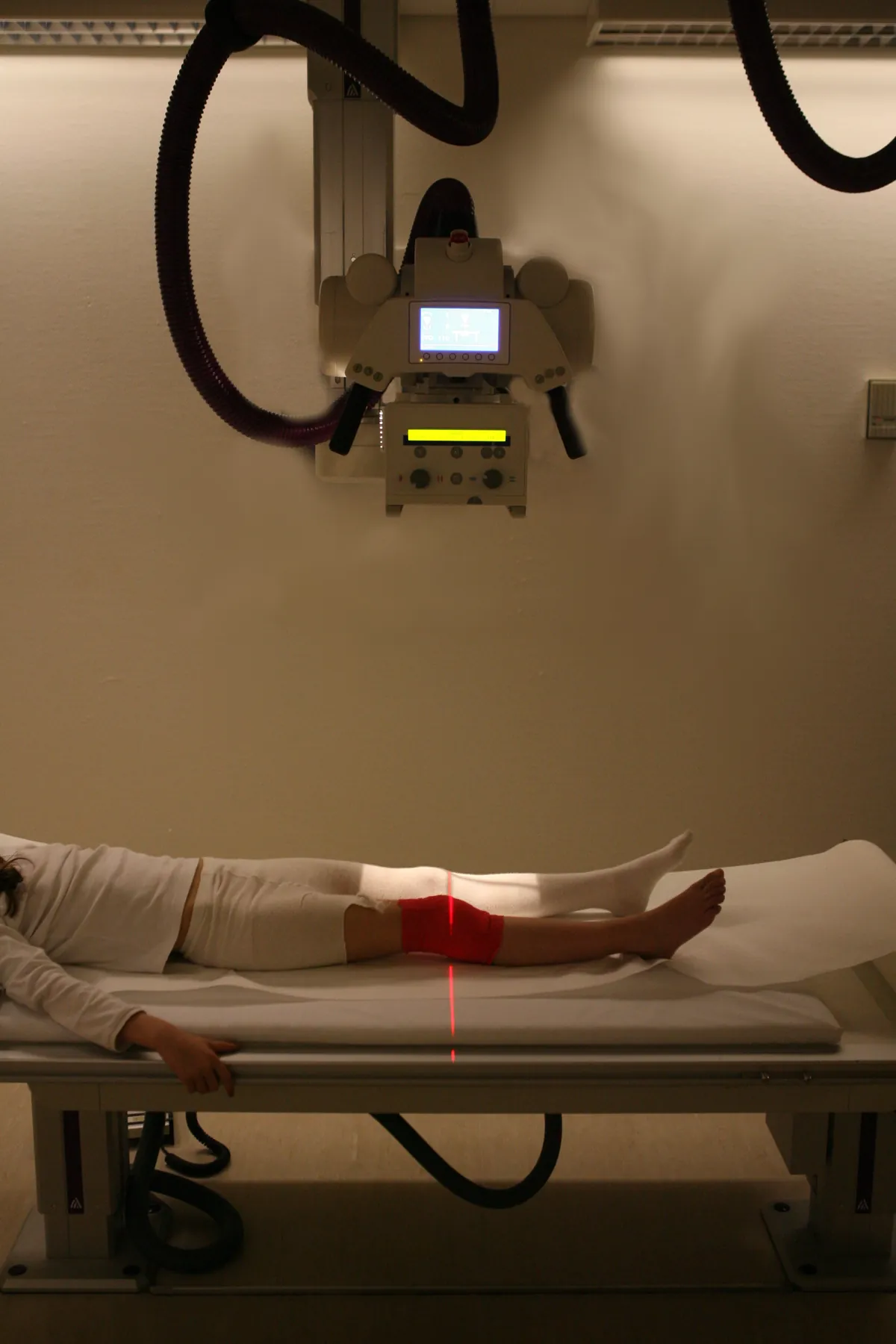 Patient allongé sur la table d'examen, genou positionné sous le tube à rayons X pour une radiographie ciblée