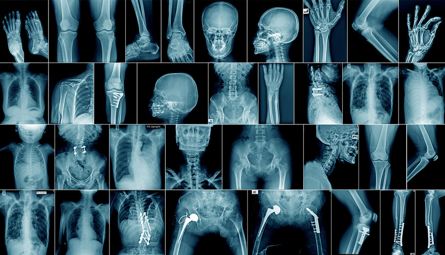 Planche de radiographies médicales : main, genou, crâne, thorax et hanche opérée, illustrant la diversité des examens d'imagerie