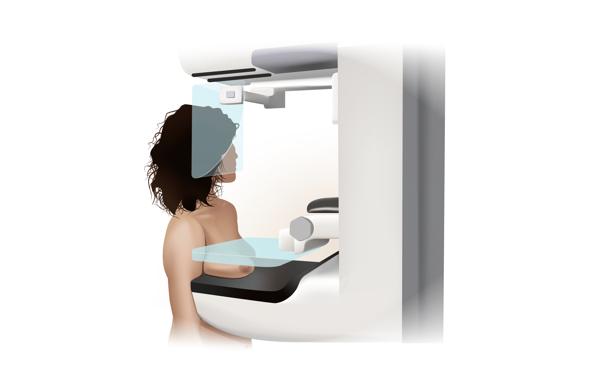 Illustration du positionnement d'une patiente devant le mammographe, sein placé entre les plaques de compression de l'appareil