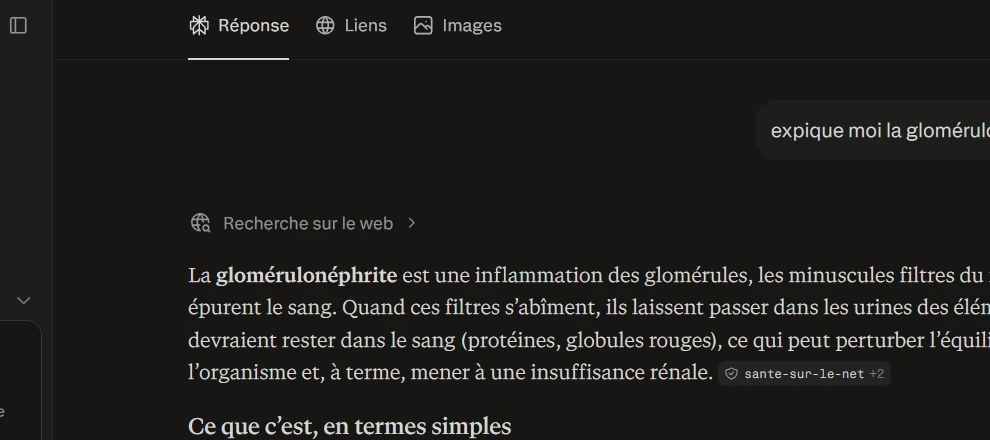 Réponse Perplexity sur la glomérulonéphrite